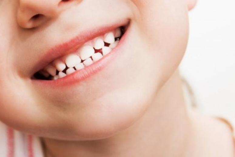 Молочные зубы нужно лечить ради здоровья коренных